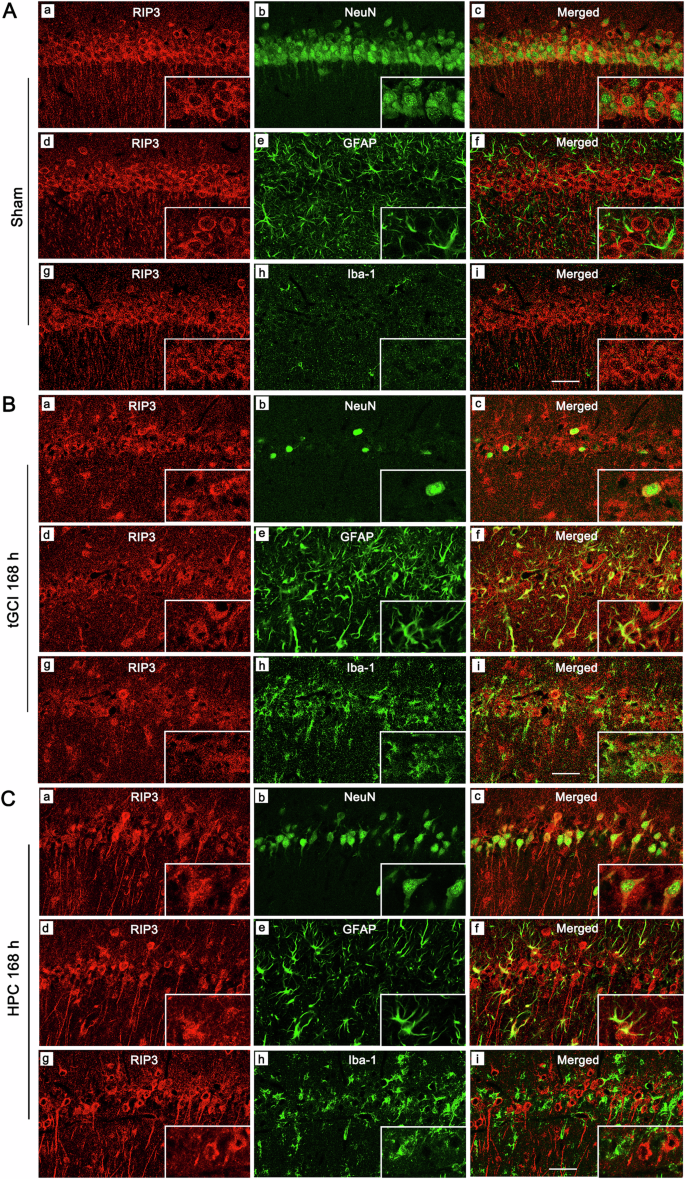 Fig. 6: The effects of HPC on the localization of RIP3 in CA1 after tGCI.