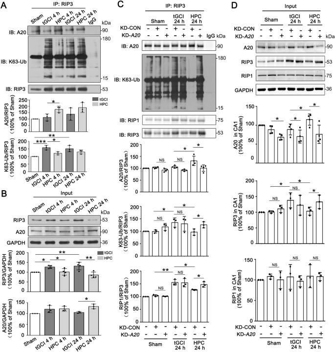 Fig. 7: HPC or silencing of A20 disrupts the interaction between A20 and RIP3, and promotes K63-linked ubiquitination of RIP3 in CA1 after tGCI.