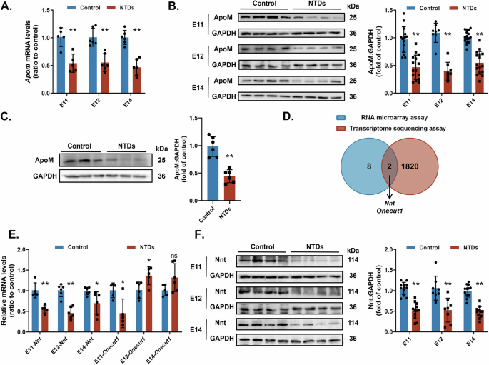 Fig. 1: ApoM and Nnt are downregulated in rat models and human fetuses with NTDs.