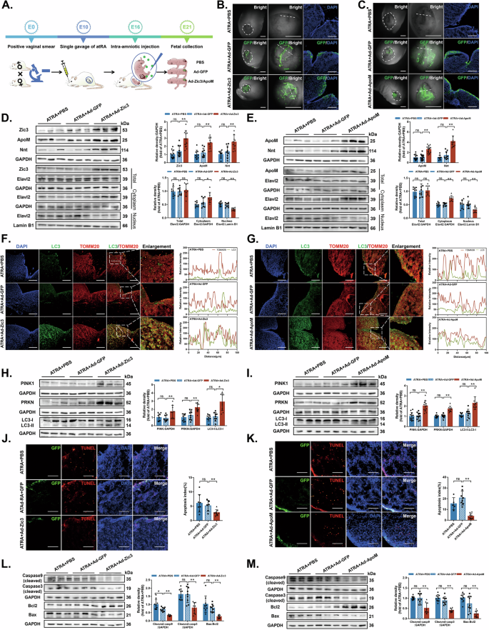 Fig. 8: Intra-amniotic injections of Zic3 or ApoM adenoviruses exert therapeutic effects by improving cell homeostasis between mitophagy and apoptosis.