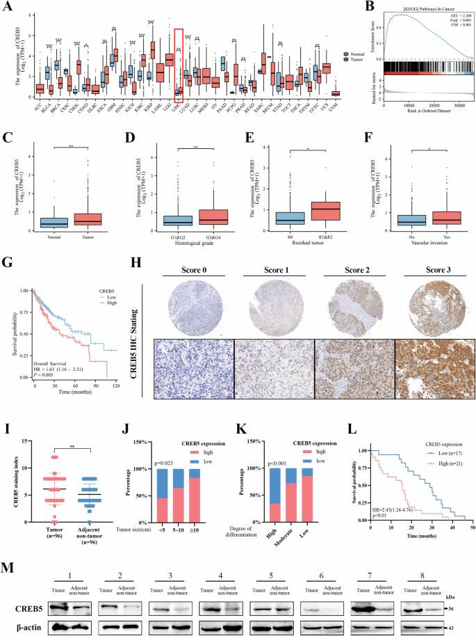 Fig. 2: CREB5 is highly expressed in HCC and associated with poor prognosis.