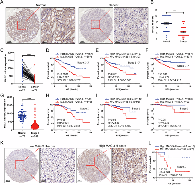 Fig. 1: Dysregulated low levels of MAGI3 correlate with poor prognosis in ccRCC.