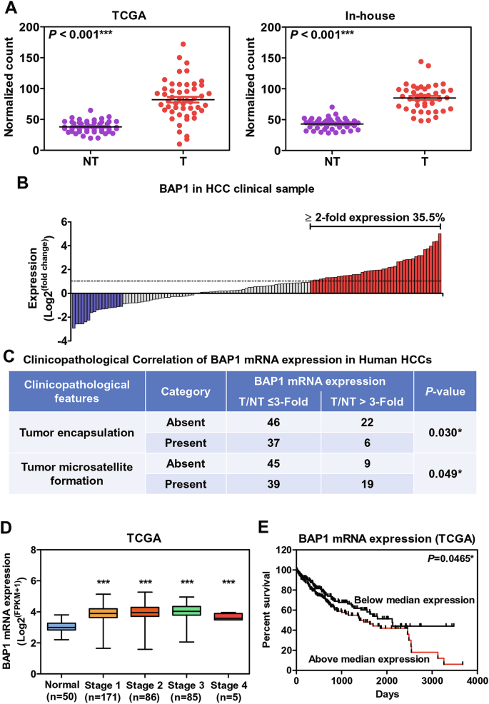 Fig. 1: BAP1 mRNA level was upregulated in human HCC with more aggressive tumor behavior.