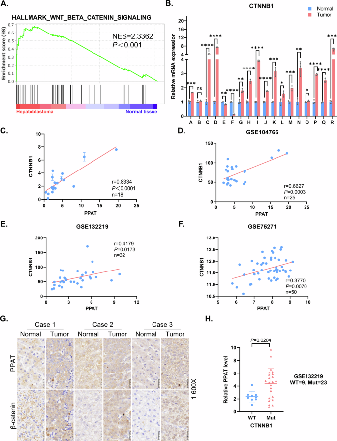 Fig. 4: The expression of β-catenin and PPAT is strongly correlated in HB.