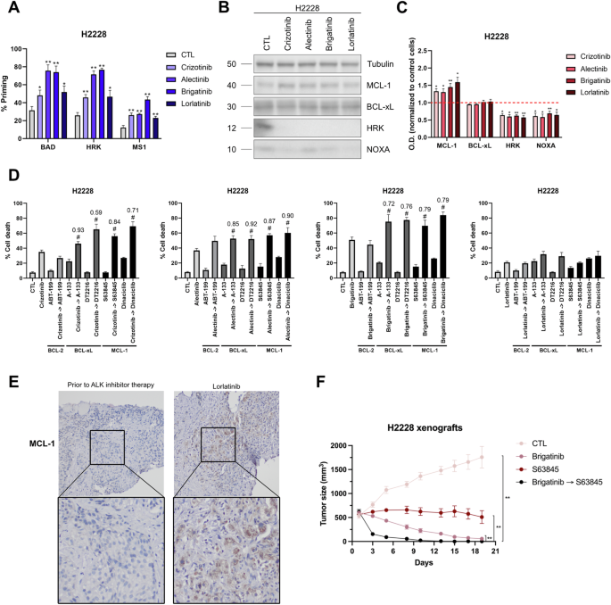 Fig. 4: Overcoming anti-apoptotic resistance to ALK inhibitors in vitro and in vivo.