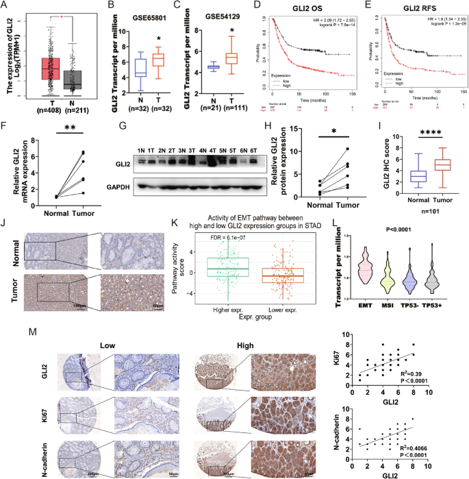 Fig. 1: High expression levels of GLI2 were observed in the GC clinical samples and predicted poor prognosis.