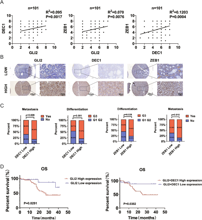 Fig. 9: GLI2 and DEC1 expression are correlated with ZEB1 expression and poor prognosis in GC.