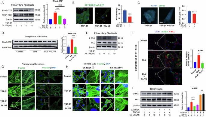 Fig. 4: GL-V9 inhibits RhoA activation in myofibroblasts and impedes the reorganization of the actin cytoskeleton.