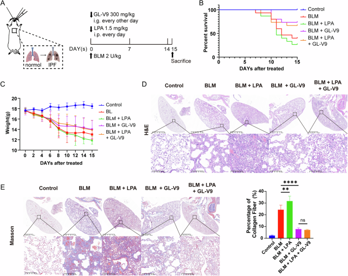 Fig. 6: GL-V9 antagonizes the pro-fibrotic effects of Rho GTPases agonist lysophosphatidic acid (LPA) in mice with bleomycin-induced pulmonary fibrosis.
