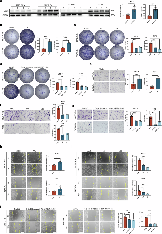 Fig. 3: Role of high MMP1 expression in enhancing migration, invasion, and proliferation of HR + BC cells.