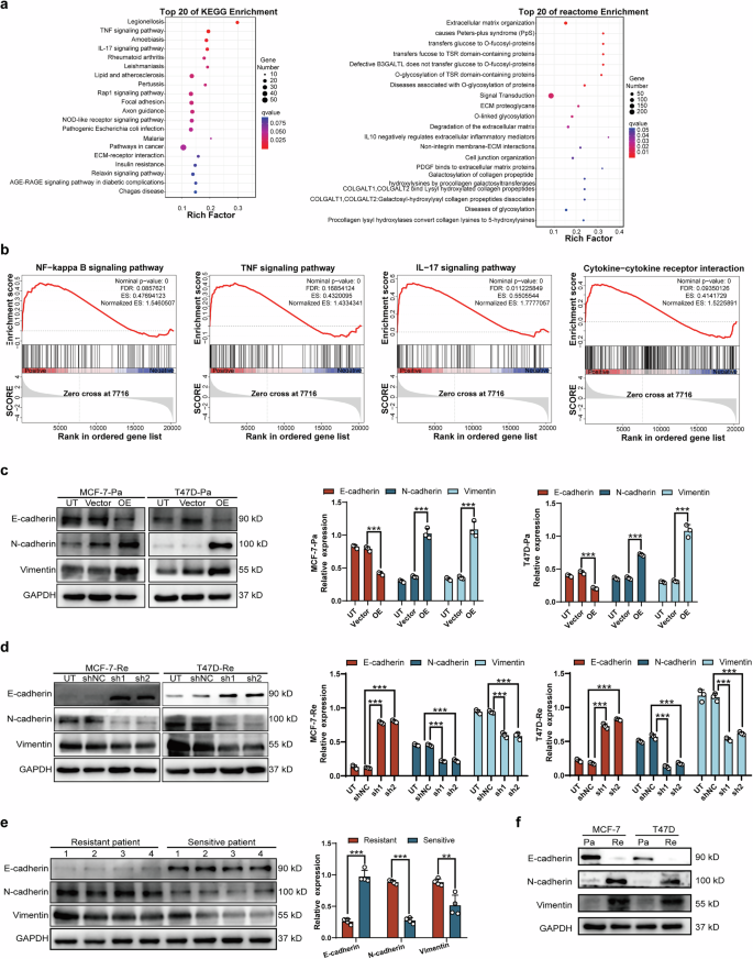 Fig. 4: MMP1-induced EMT and proliferation via NF-κB pathway activation in BC cells.