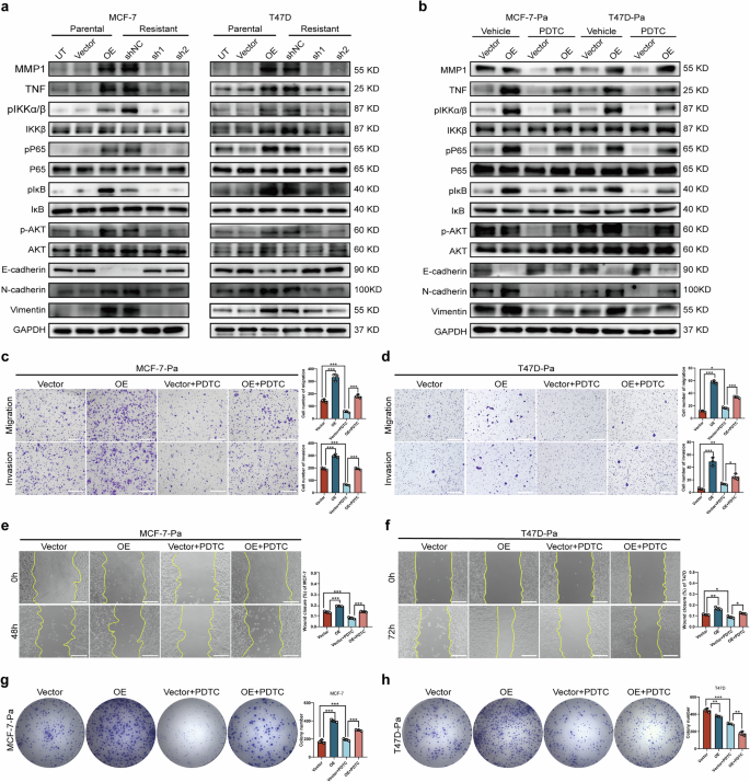 Fig. 5: MMP1 promotes EMT and proliferation by activating NF-κB pathway in BC cells.