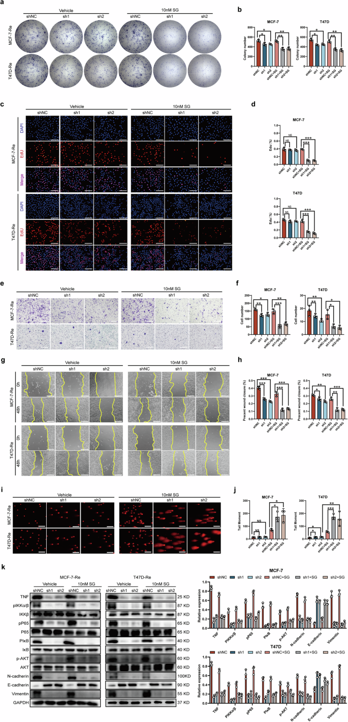 Fig. 6: MMP1 inhibition enhances SG sensitivity in SG-resistant BC cells in vitro.