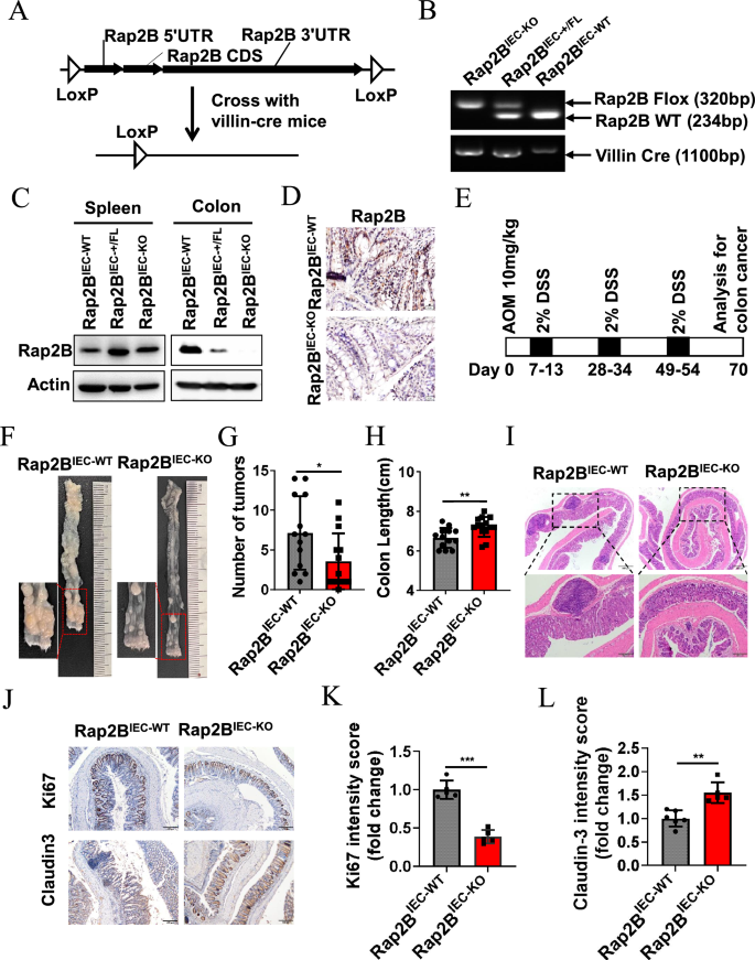 Fig. 2: IEC-specific Rap2B deletion inhibits colorectal cancer tumorigenesis.