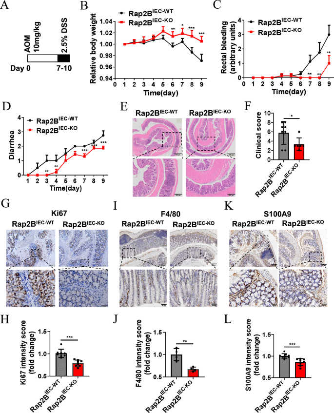 Fig. 3: IEC-specific Rap2B deletion inhibits the progression of colitis.
