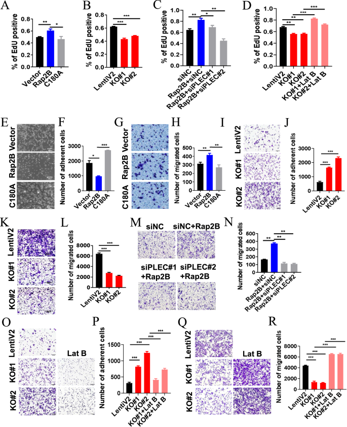 Fig. 7: Rap2B promotes colorectal cancer cell proliferation and migration depending on plectin-F-actin axis.