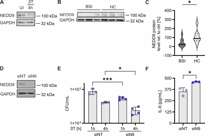 Fig. 6: NEDD9 is downregulated in human macrophages and patients with bacterial bloodstream infections (BSIs).