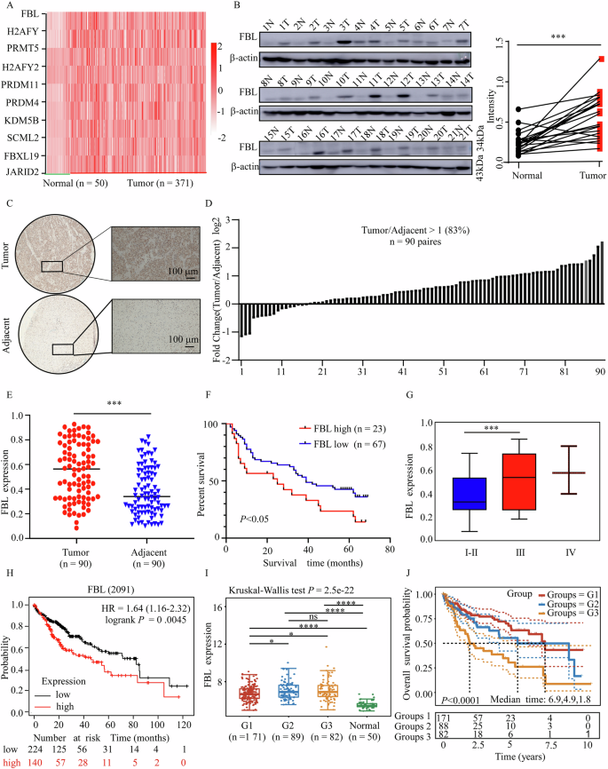 Fig. 1: FBL is upregulated in HCC and is associated with poor survival probability.