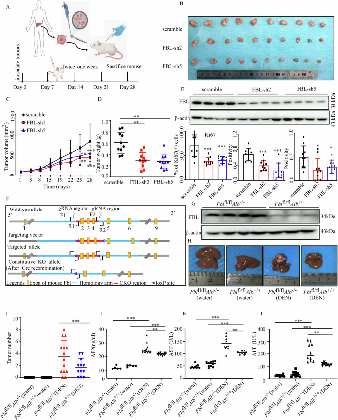 Fig. 6: FBL deficiency attenuates HCC progression in vivo.