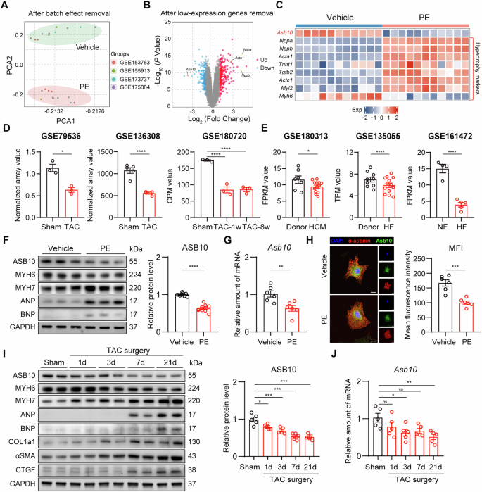 Fig. 1: Asb10 is downregulated in pathological cardiac hypertrophy in vitro and in vivo.