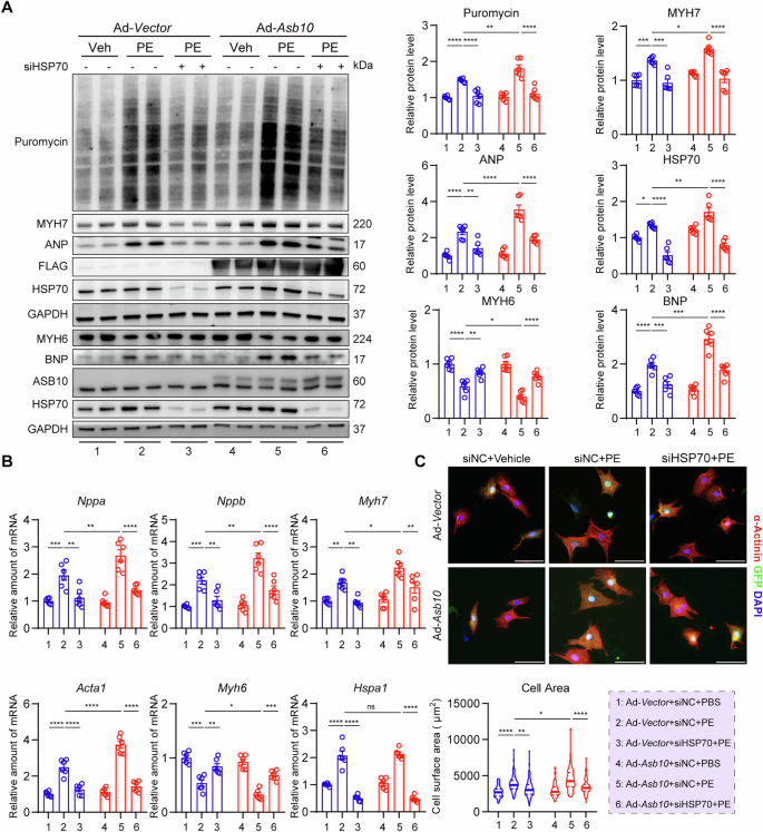 Fig. 5: Downregulation of HSP70 partially rescues Asb10 overexpression-induced hypertrophic growth in NRVMs.