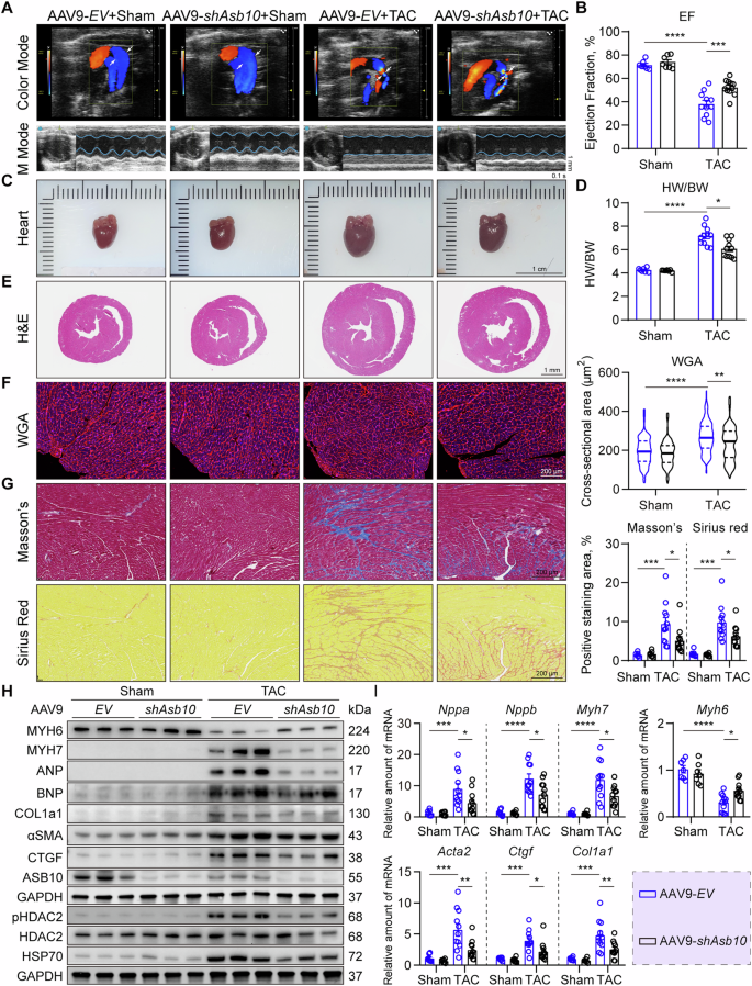Fig. 8: Cardiac-specific Asb10 knockdown ameliorates pathological hypertrophy and reduces HDAC2 phosphorylation in response to pressure overload.