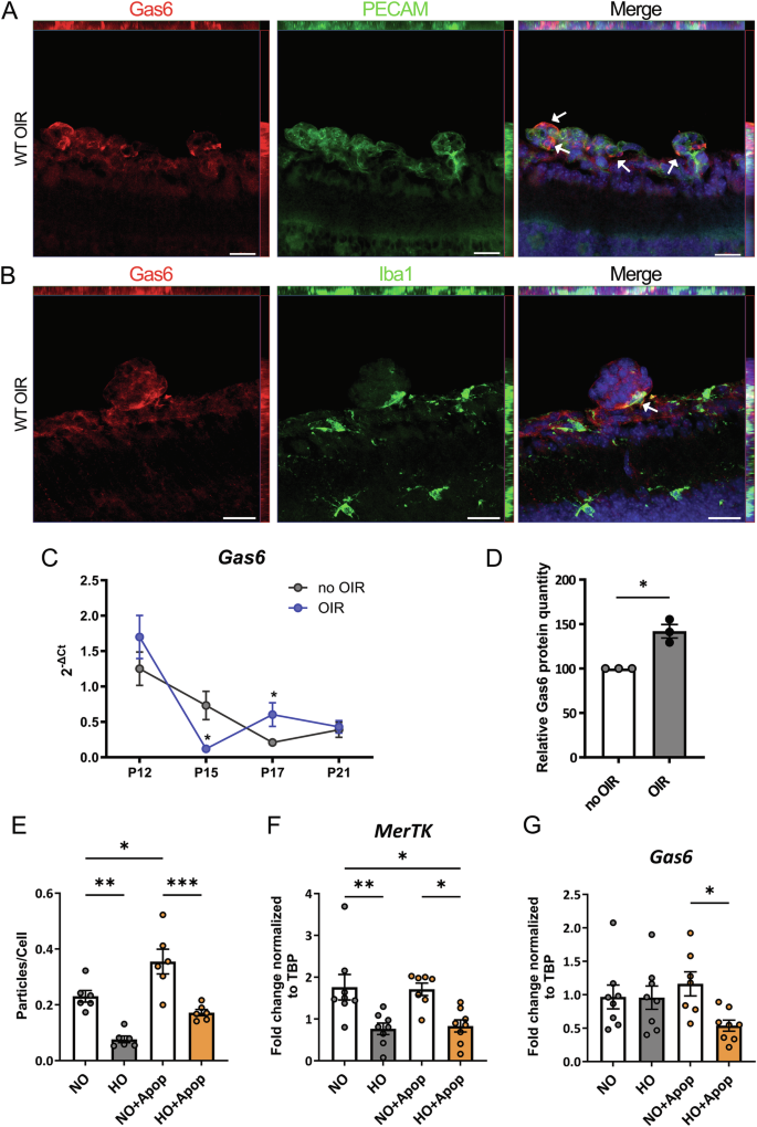 Fig. 2: GAS6 expression in the OIR model.