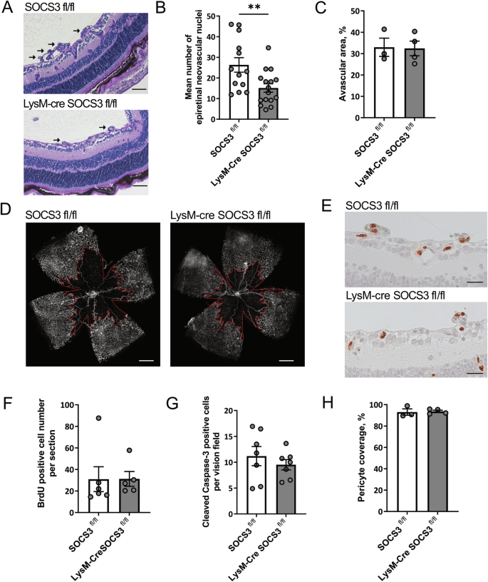 Fig. 3: Myeloid SOCS3-deficiency decreases pathological angiogenesis in the OIR model without effects on revascularization.