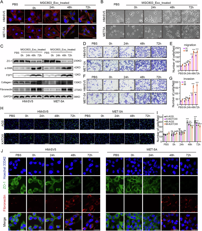Fig. 2: GC cell-derived exosomes promoted the mesenchymal transition of mesothelial cells in vitro.