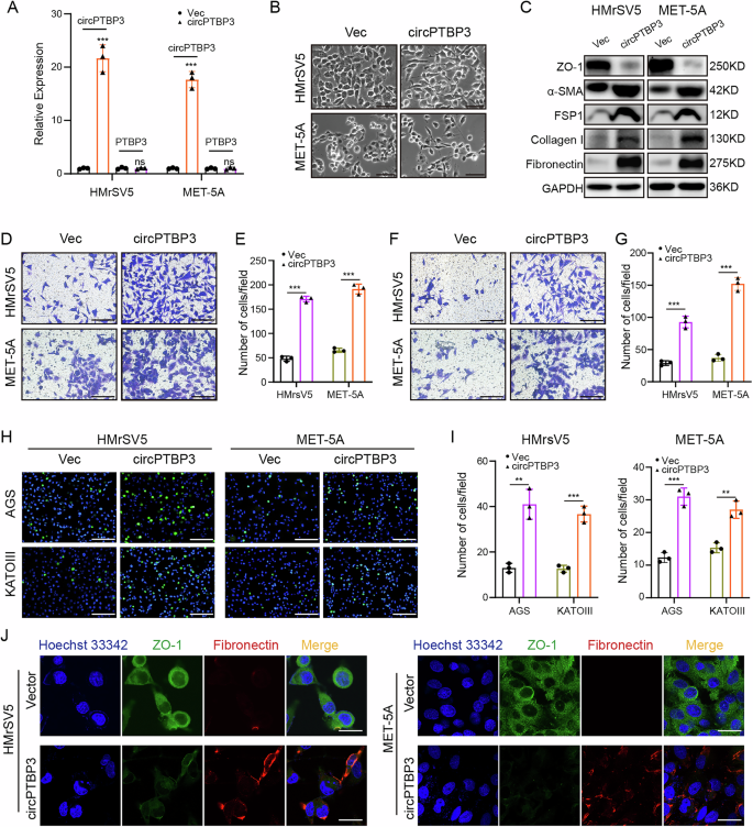Fig. 4: circPTBP3 overexpression induced the MMT of mesothelial cells in vitro.