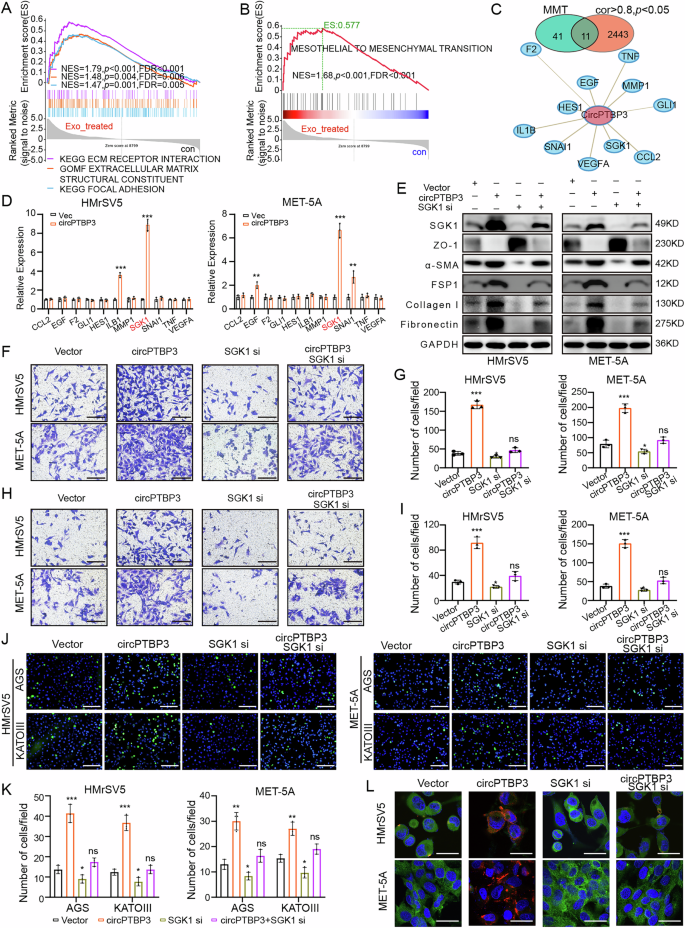 Fig. 6: circPTBP3 mediated MMT by regulating SGK1 expression.