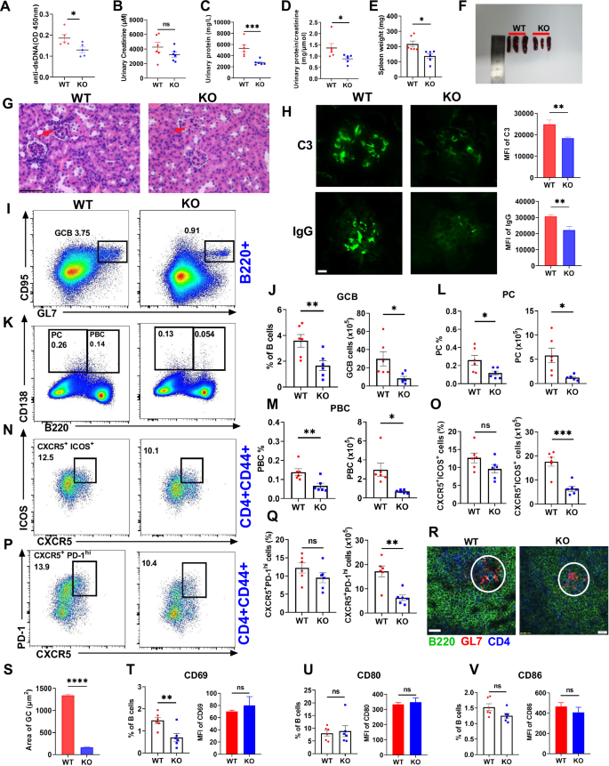 Fig. 6: MBD2 deficiency ameliorates lupus-like autoimmunity and renal injury in a cGVHD model.