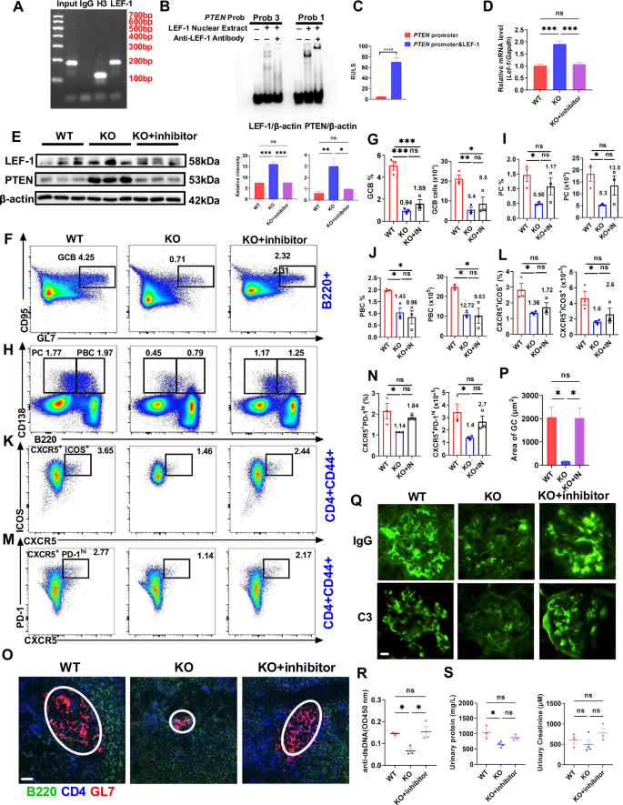 Fig. 8: MBD2 regulates PTEN expression by inhibiting Lef-1 transcription.