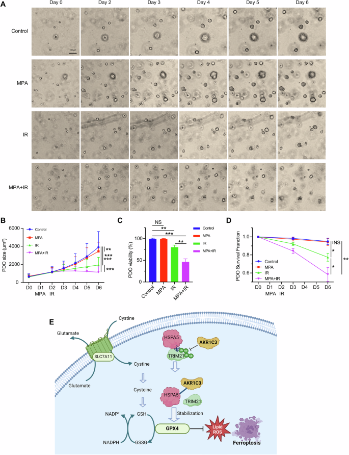 Fig. 7: Inhibition of AKR1C3 resensitizes EAC PDOs to radiotherapy.