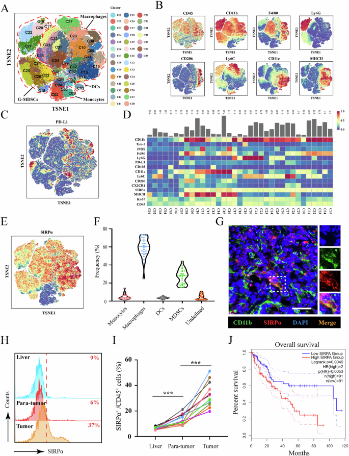 Fig. 1: SIRPα was upregulated in TIMs and correlated with the poor prognosis of HCC patients.