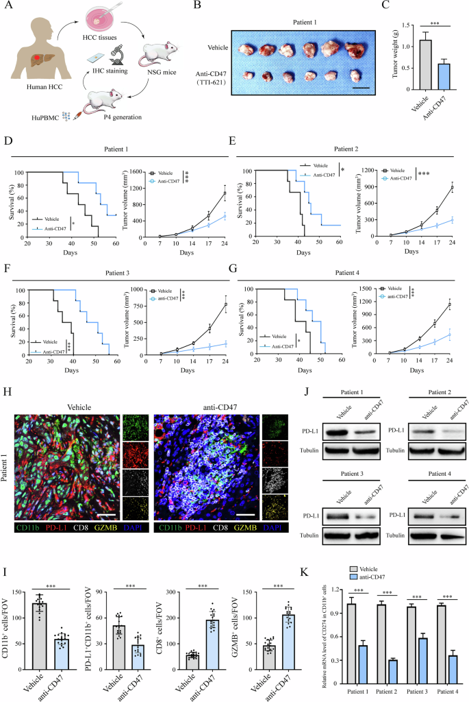 Fig. 4: CD47 blockade therapy suppressed tumor progression in the PDX model.