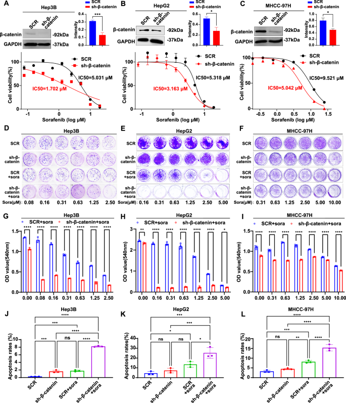 Fig. 3: β-catenin regulates resistance to sorafenib in HCC.