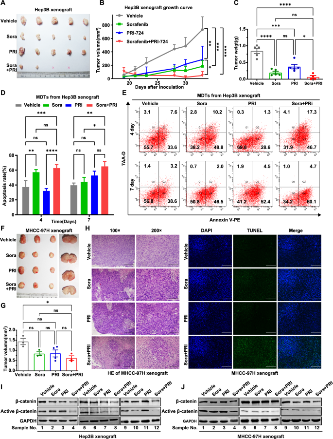Fig. 6: Inhibition of β-catenin activity enhances the antitumor activity of sorafenib against HCC xenografts.