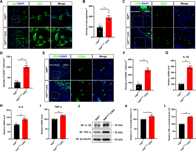 Fig. 3: IS was aggravated with more inflammatory infiltration in YAPGFAP-CKO mice.