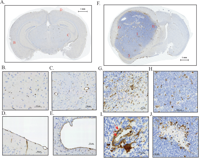 Fig. 2: TGM2 expression in normal and human glioblastoma xenograft mouse brain.