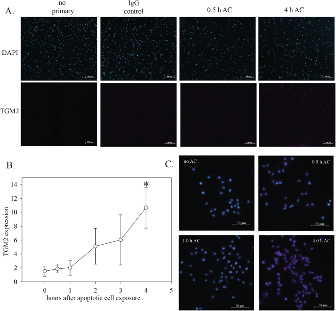 Fig. 5: TGM2 expression during macrophage efferocytosis in cell culture.