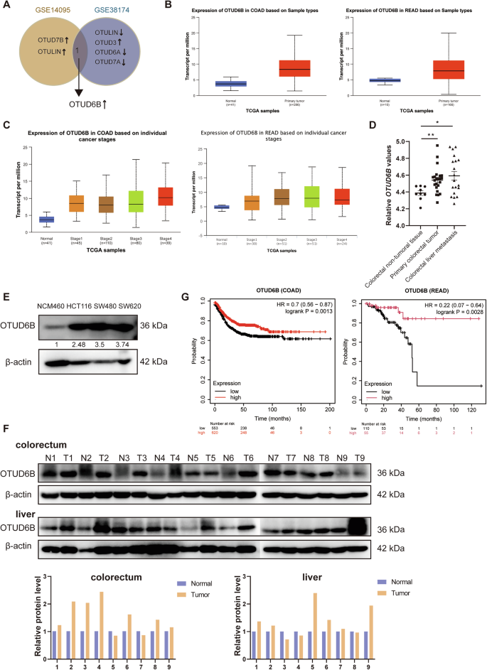 Fig. 1: OTUD6B is overexpressed in CRC and positively correlated with survival rate.