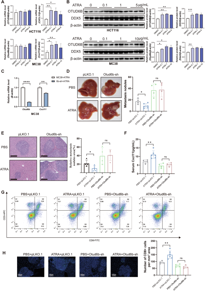 Fig. 7: ATRA upregulates OTUD6B to inhibit CRC liver metastasis.