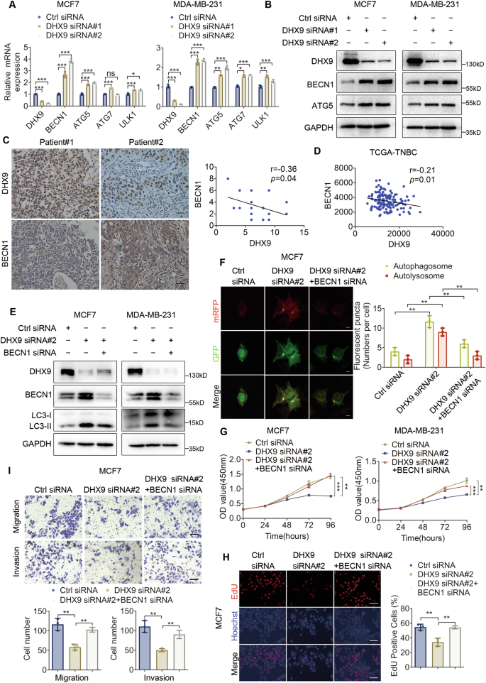 Fig. 4: BECN1 knockdown reverses the biological effects of DHX9 silencing on BC cells.