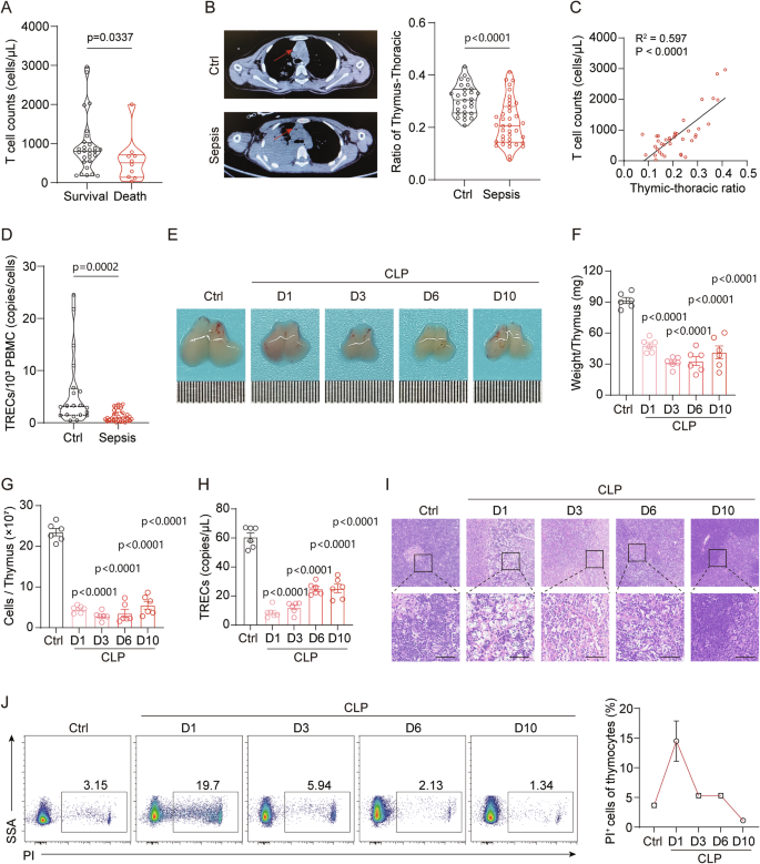 Fig. 1: Thymic involution in pediatric sepsis and polymicrobial sepsis mouse model.