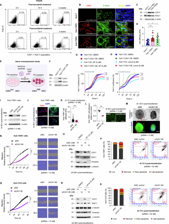 Fig. 2: CAV1 regulates survival, motility and apoptosis in TKI-resistant HCC cells via modulating RAC1 and vimentin.
