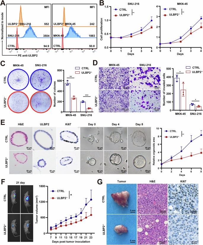 Fig. 2: ULBP2 promotes the malignant phenotype of GC.