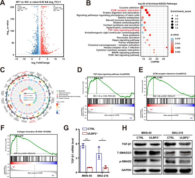 Fig. 3: ULBP2 activates TGF-β signalling and collagen formation in GC.
