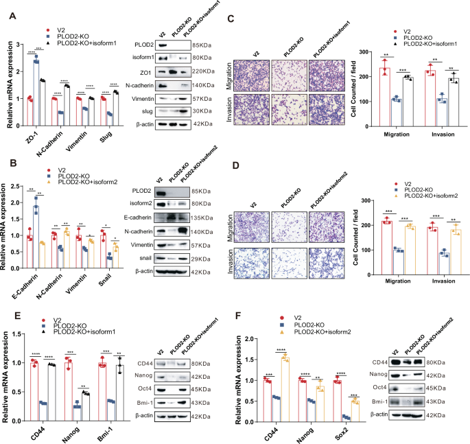 Fig. 6: Both DCLK1-L variants are essential for hypoxia-PLOD2-driven cancer invasiveness and stemness.