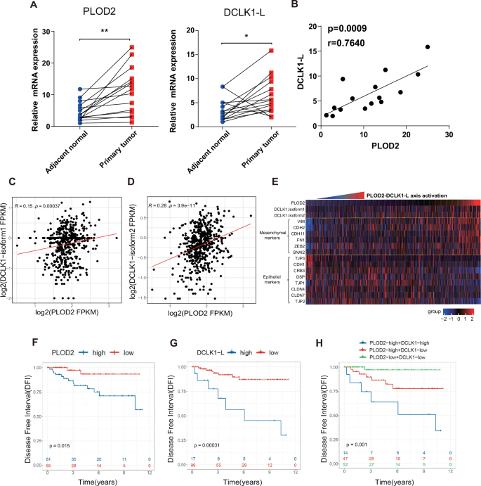 Fig. 7: Hyperactivation of the PLOD2-DCLK1-L axis is associated with an unfavorable prognosis in ccRCC.